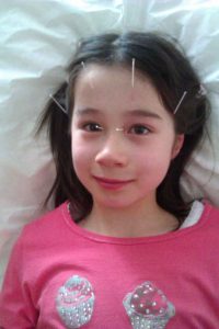 child acupuncture (1)
